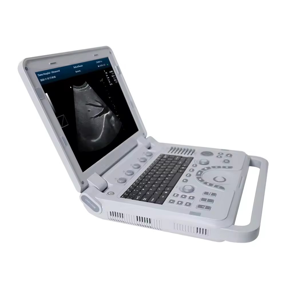 Veterinary equipment portable ultrasound scanner veterinary ultrasound machine