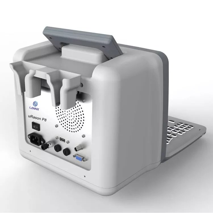 LANNX uRason P8 Portable Mobile Ultrasound Machine Laptop B-Ultrasound Diagnostic System Machine For Ultrasound