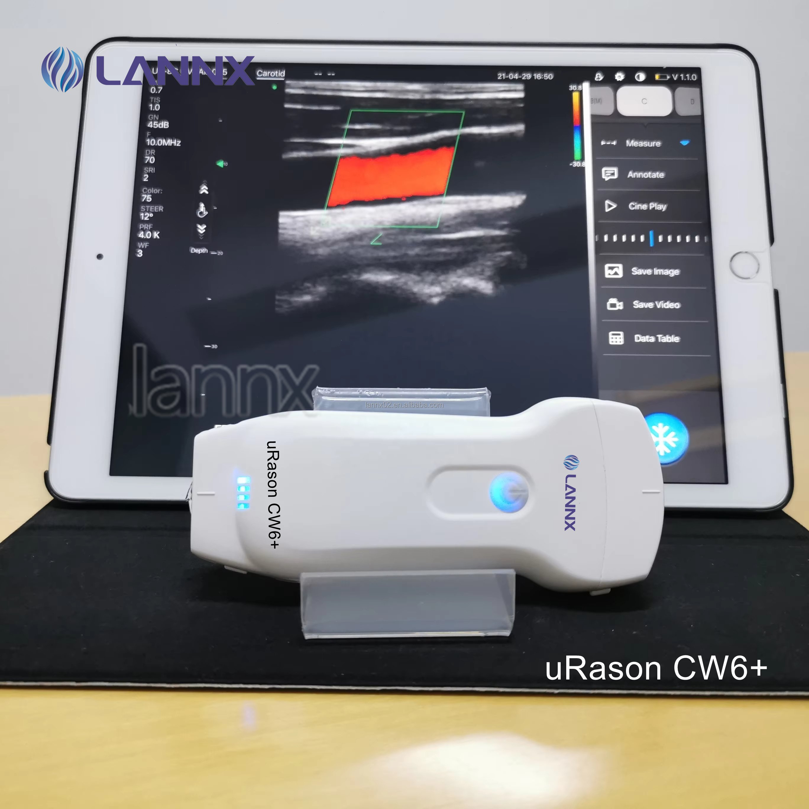 LANNX URason CW6+ Full Digital Wireless Probe Mobile Ultrasound For Hospital Medical Portable Handheld Ultrasound Machine