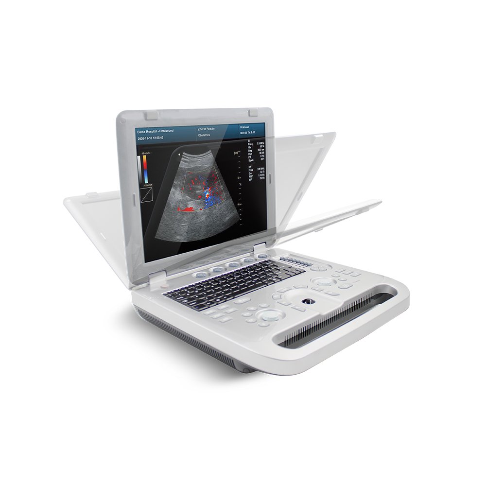 CMS1700A Laptop Digital 3D 4D Ultrasound Machine Cheapest Price Animal Ultrasonic Instrument