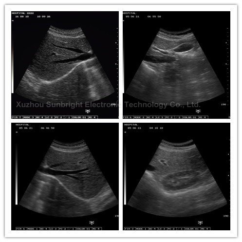 2D Medical Ultrasound Instruments SUN-806G ecografia portatil Ultrasound Portable Machine