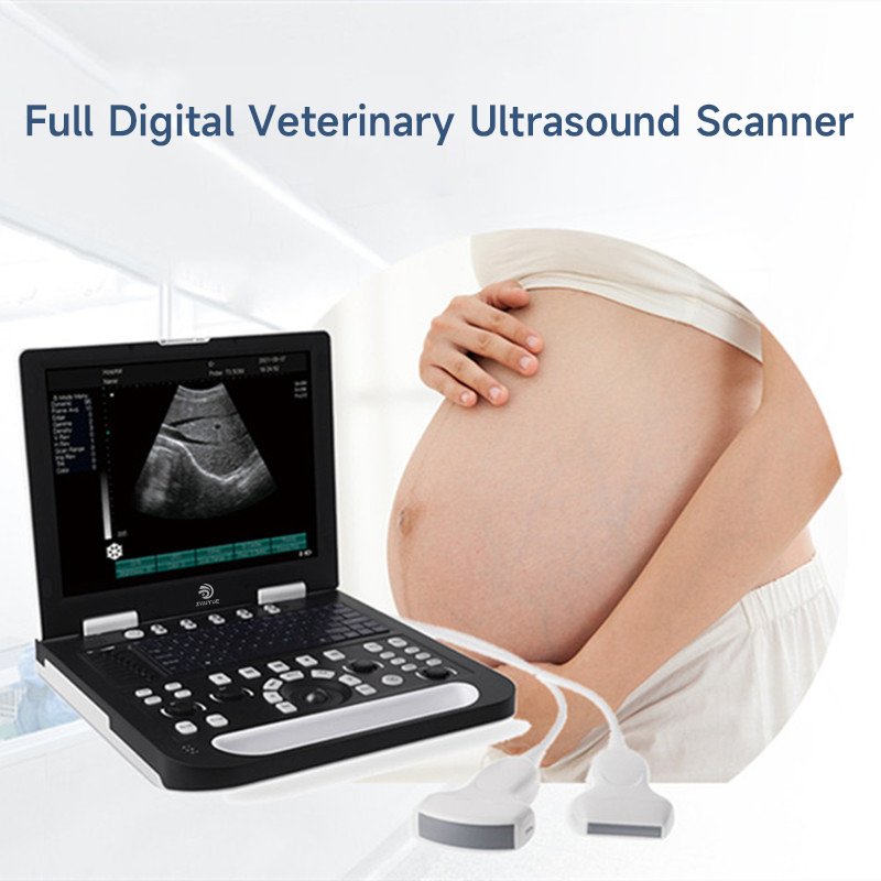 Medical equipment professional handheld HD wireless color portable Doppler probe ultrasound machine