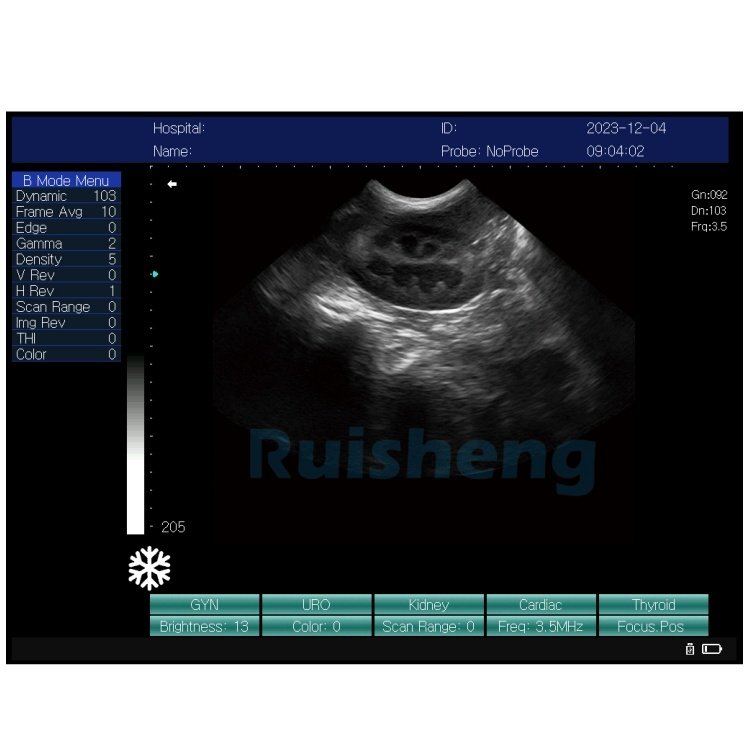 Medical Ultrasound Instruments Black and White Ultrasound Scanner Portable Full Digital B/W Ultrasound Machine