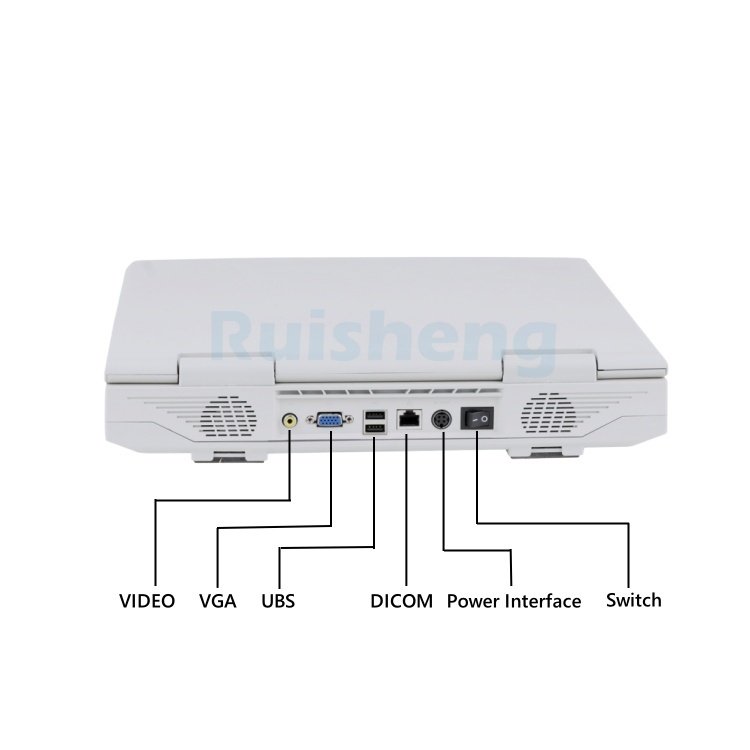 Medical Ultrasound Instruments Black and White Ultrasound Scanner Portable Full Digital B/W Ultrasound Machine