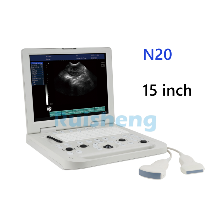 Medical Ultrasound Instruments Black and White Ultrasound Scanner Portable Full Digital B/W Ultrasound Machine