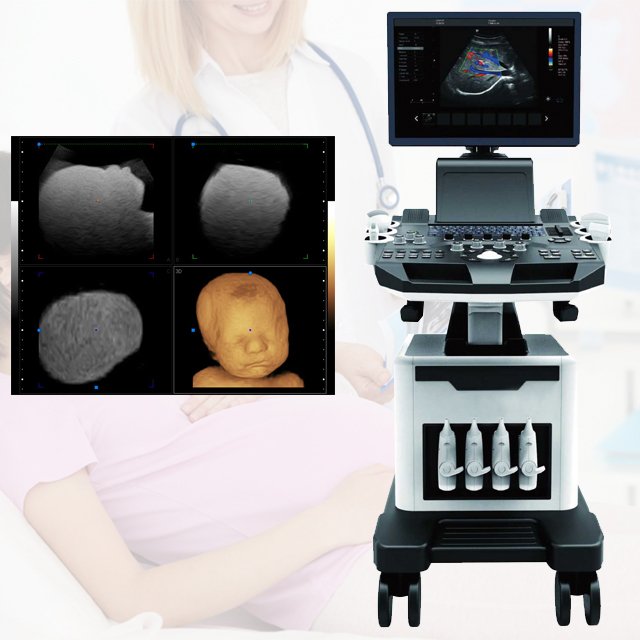 Medical Equipment Factory High Quality 4d Portable Color Doppler Ultrasound System Machine With Cradiac Probe Price