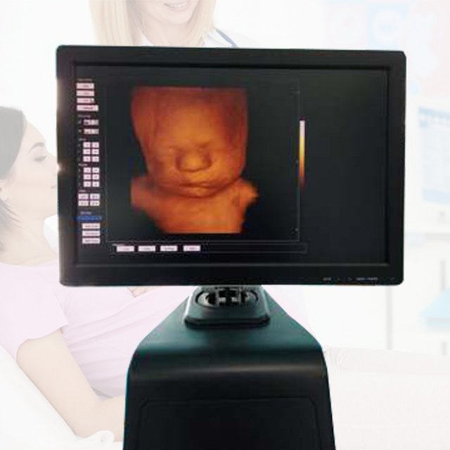 Medical Equipment Factory High Quality 4d Portable Color Doppler Ultrasound System Machine With Cradiac Probe Price