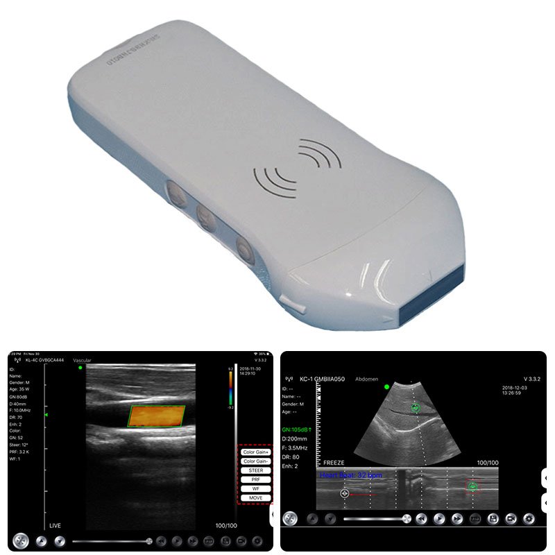 color Doppler wireless linear ultrasound 192 elements 10MHz-12MHz linear ultrasonic probe medical ultrasound instruments