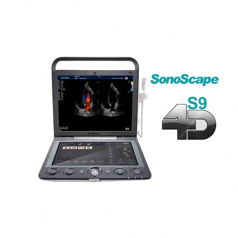 medical ultrasound instruments ecografo sonoscape Real-time ecograf sonoscape Sonoscape S9 portable color doppler ultrasound