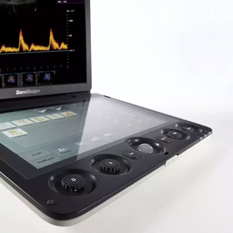 medical ultrasound instruments ecografo sonoscape Real-time ecograf sonoscape Sonoscape S9 portable color doppler ultrasound
