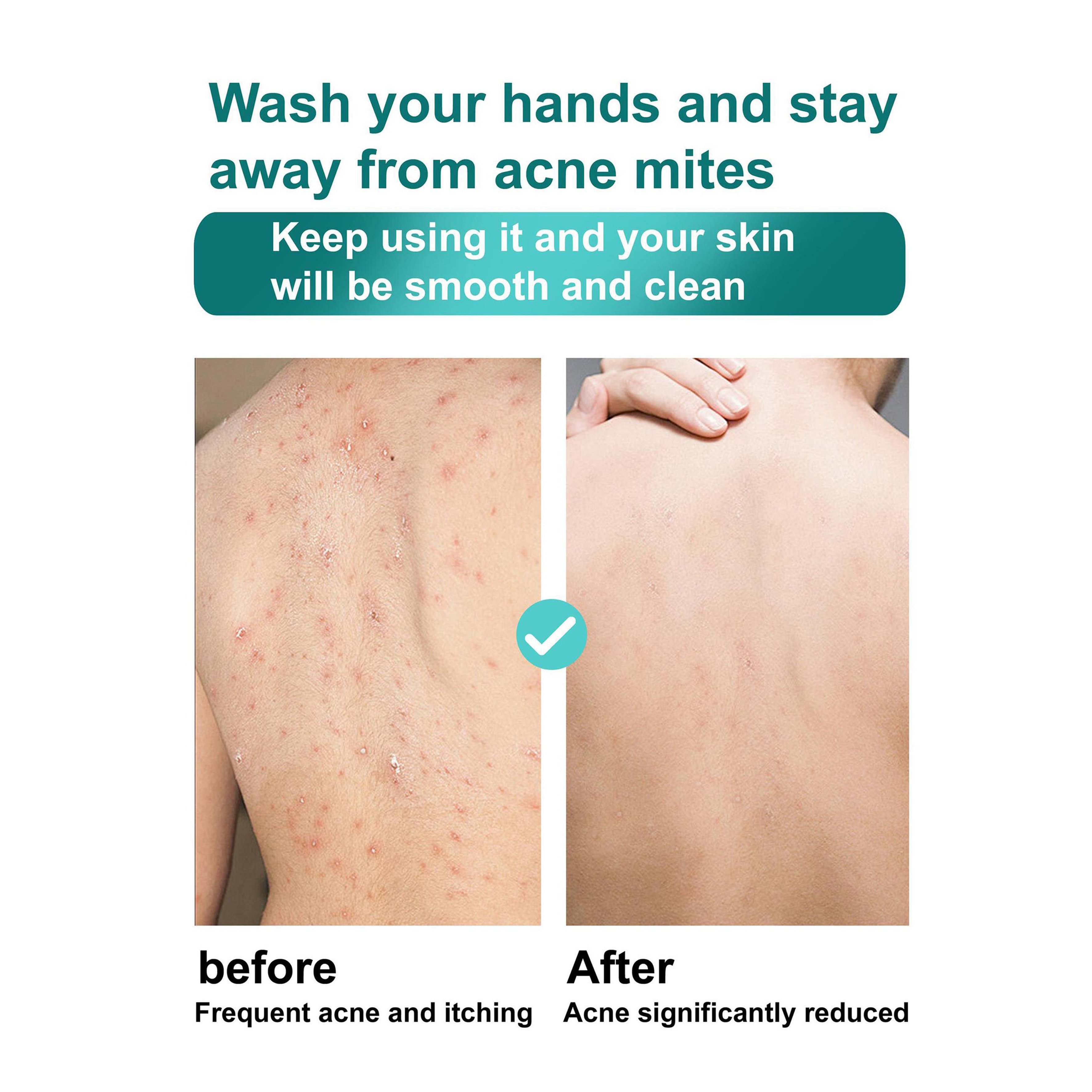 ROUSHUN Shower Gel Arbutin Kojic Acid Scrub Shower Gel
