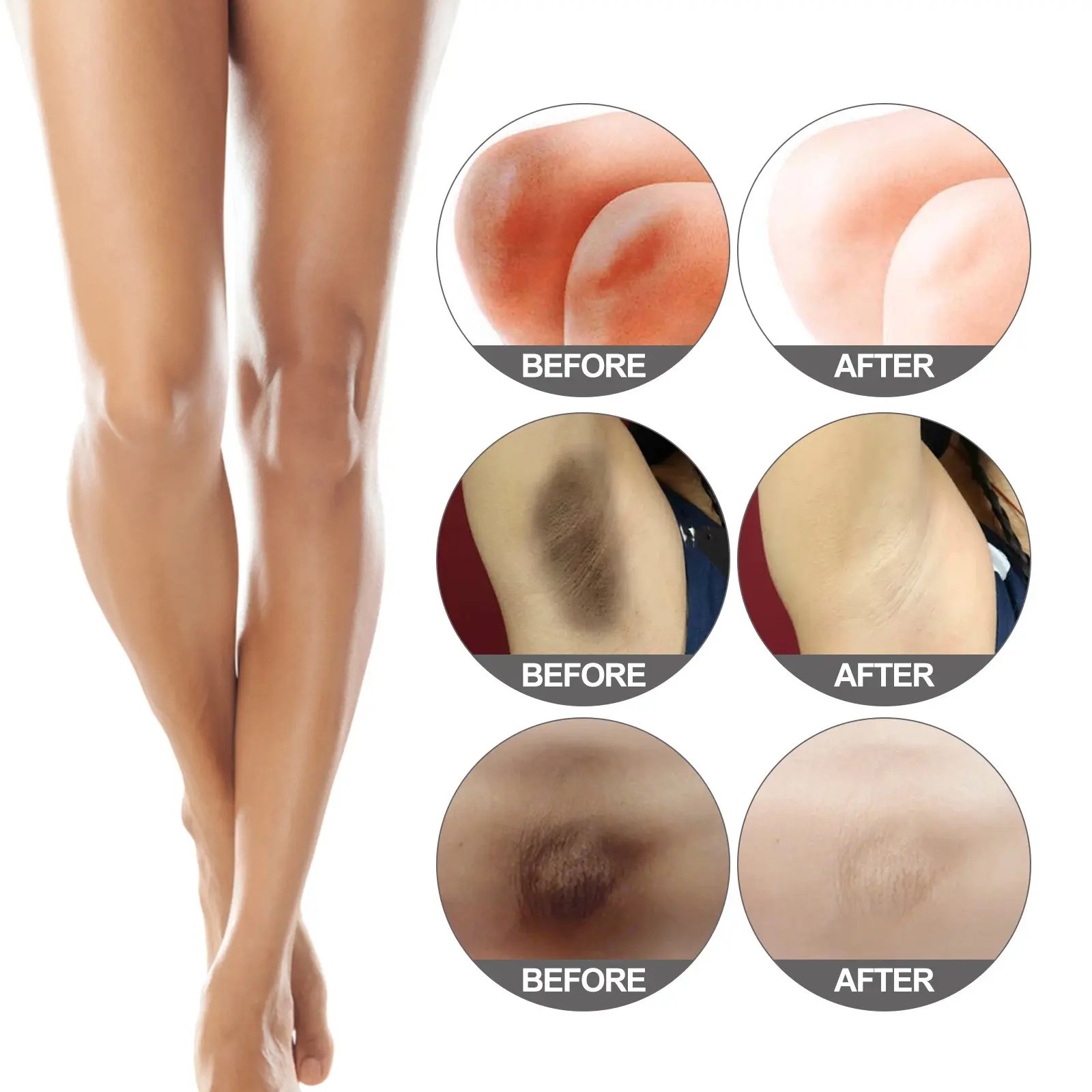 Effective black cream desalting armpit thigh inner joint melanin whitening 30ml wholesale price