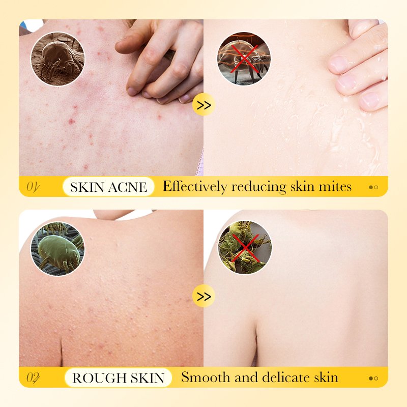 OEM SADOER High Quality Private Label Sulfur Shower Gel Body Wash Scrub Exfoliating Whitening Hydrating Refresh Body Care