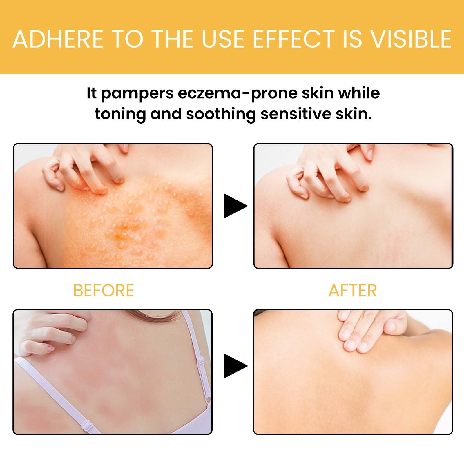 Deep cleansing, moisturizing, rejuvenating, relieving skin redness, dryness and itching, skin care shower gel, honey shower gel