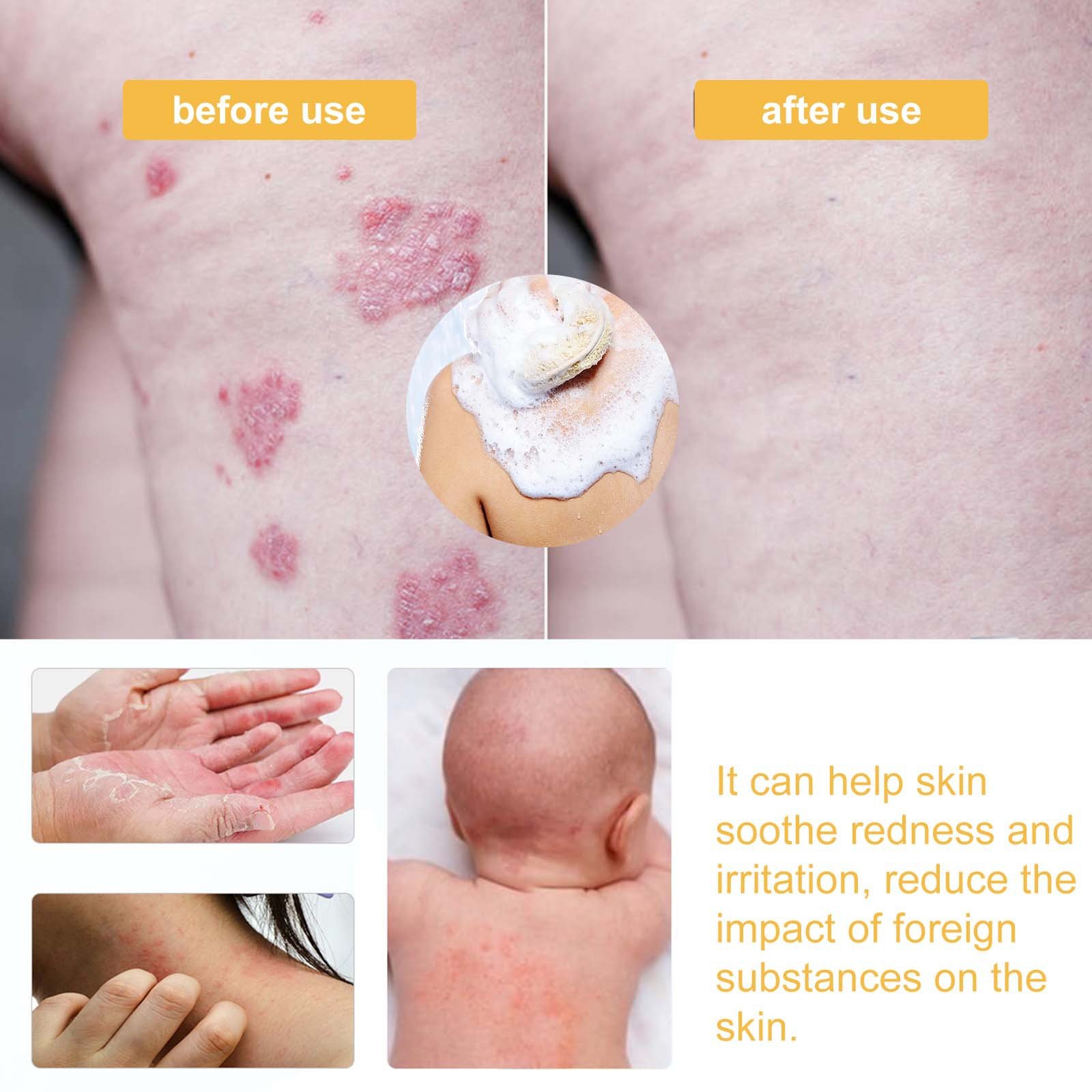 Deep cleansing, moisturizing, rejuvenating, relieving skin redness, dryness and itching, skin care shower gel, honey shower gel