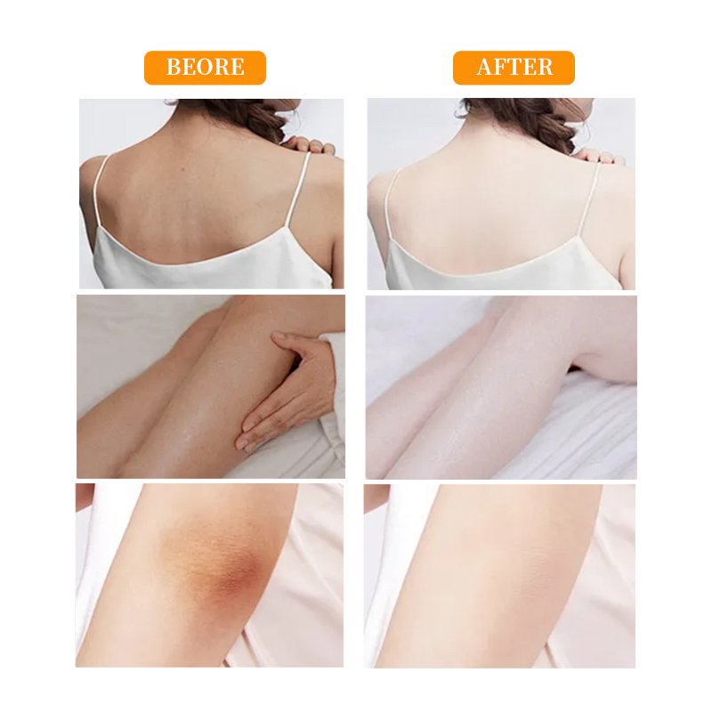 1000ml Organic VC Whitening Moisturizing Shower Gel with Custom Label Improved Dry Skin and Clean Stratum Corneum