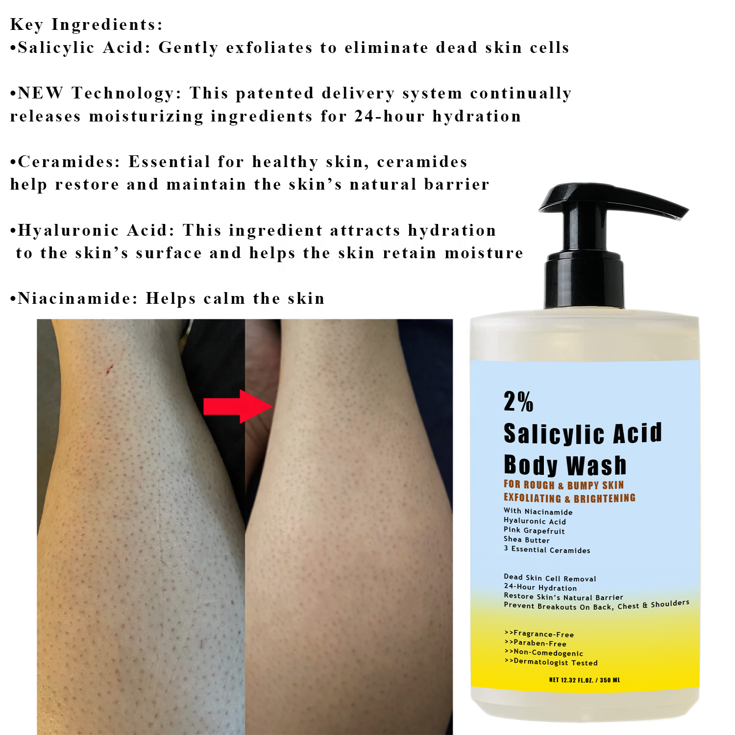 Anti acne 2% Salicylic Acid BHA Body Scrub Wash Shower Gel For Rough Bumpy Skin Exfoliating With Niacinamide Hyaluronic Acid