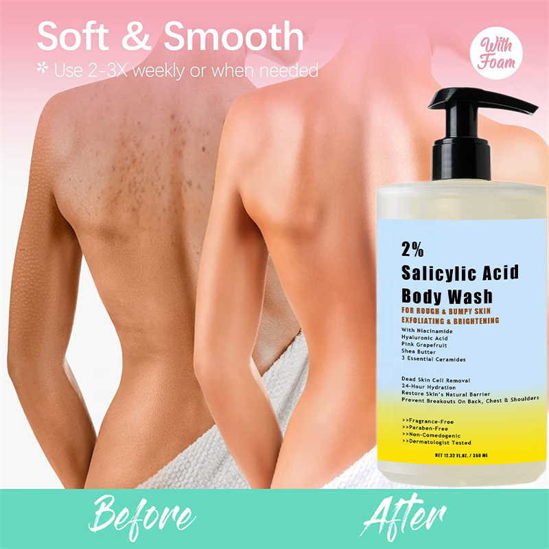 Anti acne 2% Salicylic Acid BHA Body Scrub Wash Shower Gel For Rough Bumpy Skin Exfoliating With Niacinamide Hyaluronic Acid
