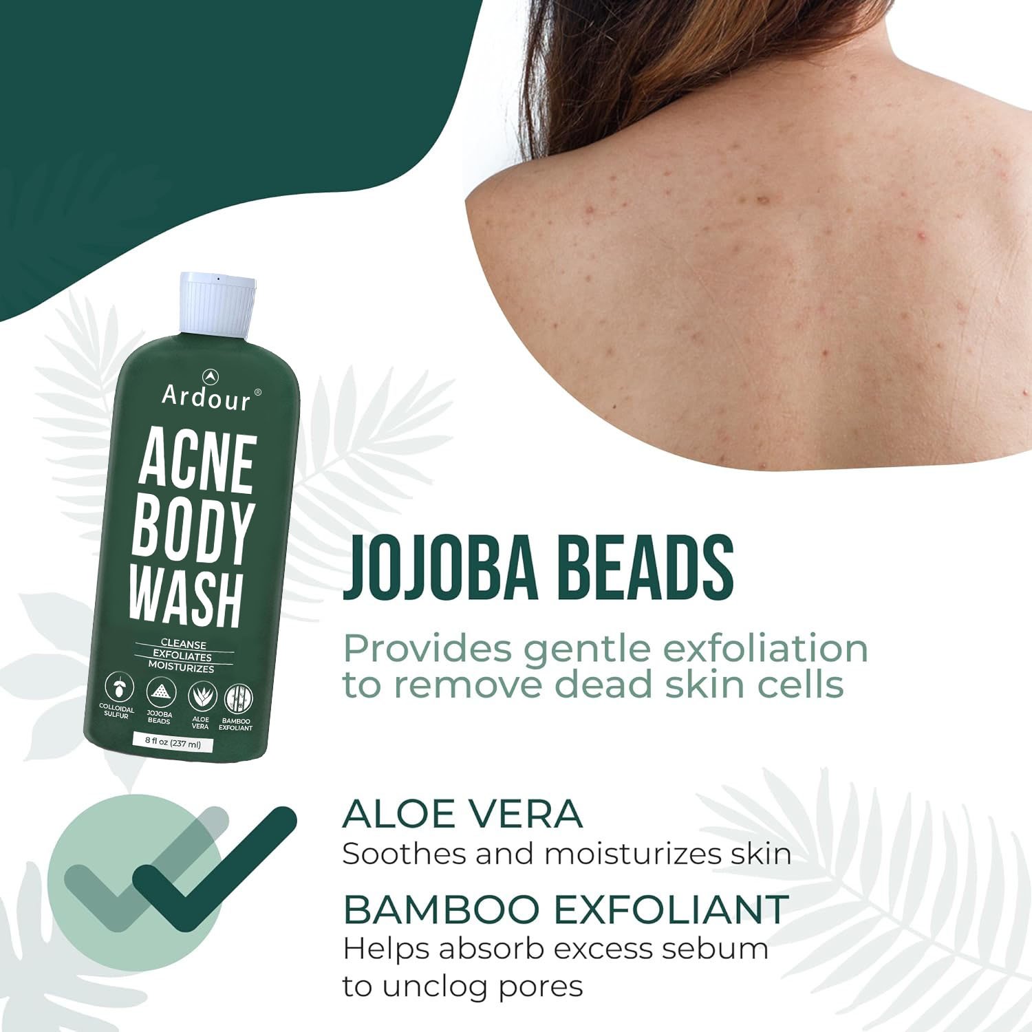 Exfoliating Body Wash Shower Gel Body Acne Wash for Back Chest Shoulder Treatment with Jojoba Beads Back Acne Body Wash Soothing