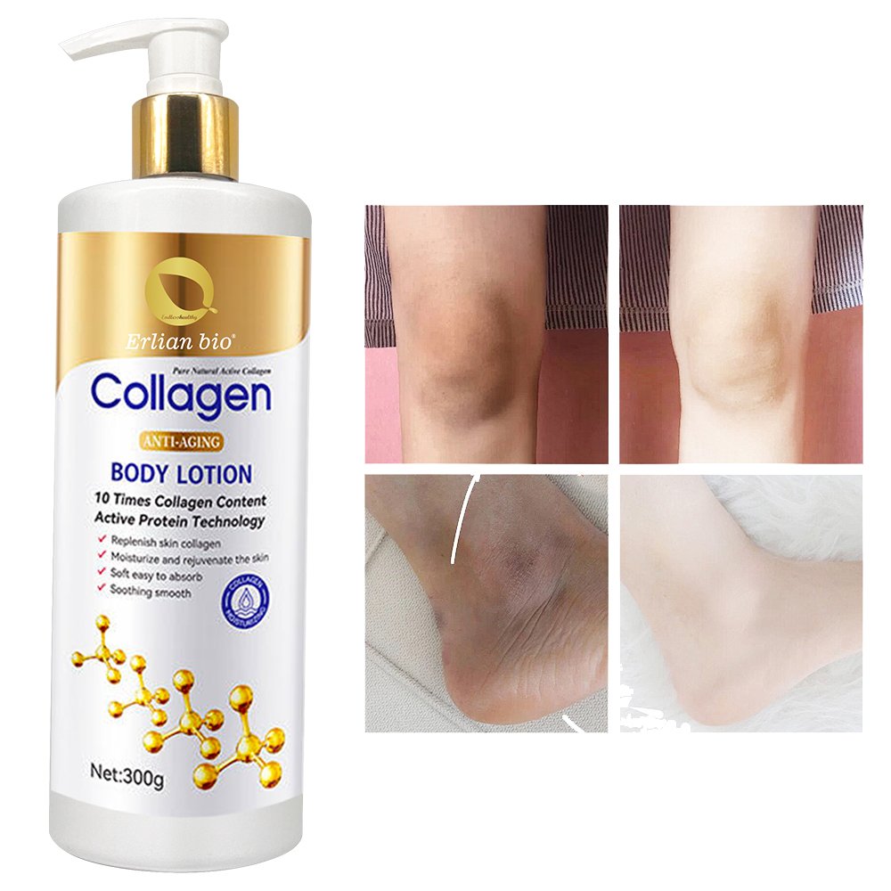Customized Manufacturers Whitening Body Lotion Exfoliator Mite Removal Acne Removal Body Lotion Adults Body Lotion 10 Sets