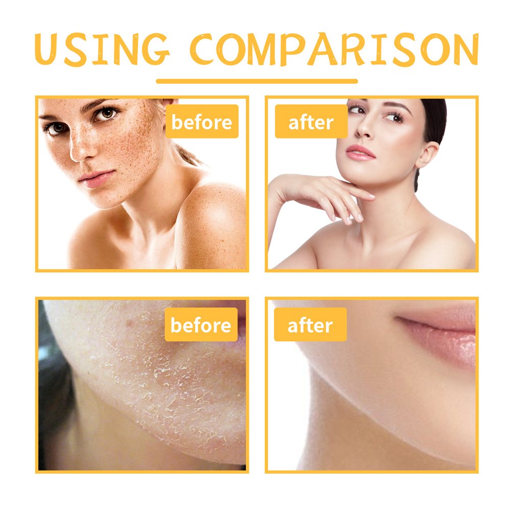 Moisturizing whitening turmeric ginger scrub, deep exfoliating chicken skin, moisturizing and softening skin keratin shower gel