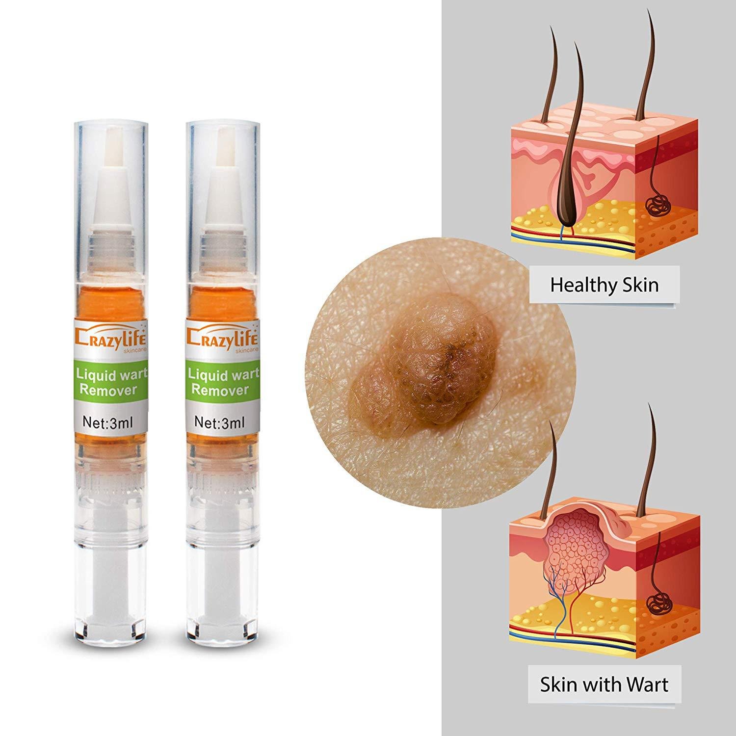 Crazylife AliExpress Pen Wart Liquid Wart Spirit Flat Youji Eye Pen Multi Pack 4ml