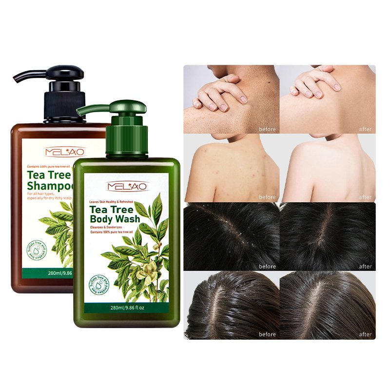 Body Acne Treatment Skin Deep Clean Tea Tree Oil Body Wash Lotion Moisturizing Bath Shower Gel