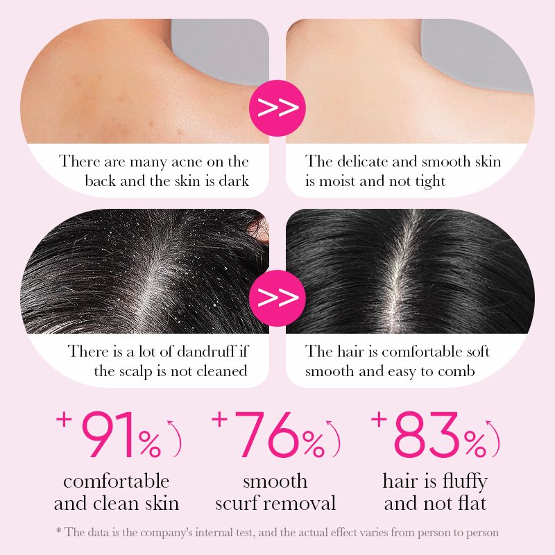 OEM SADOER private label women bath gift sets rose jasmine anti dandruff fluffy shampoo lavender fragrance bath gel body wash