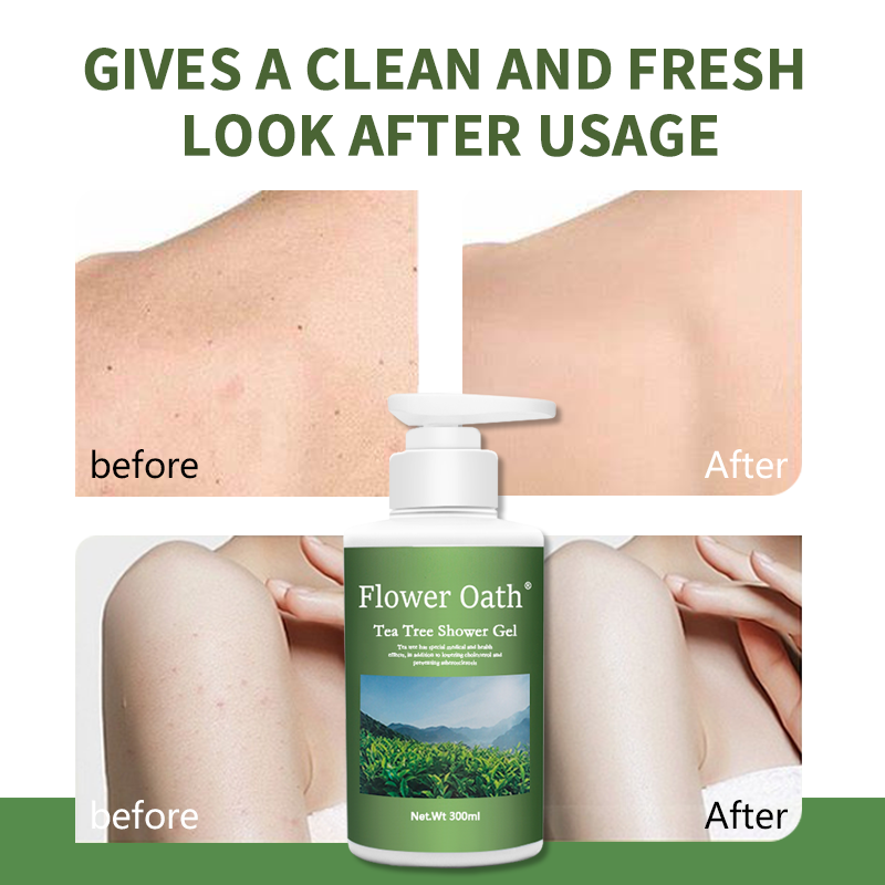 Effectively reducing acne bacteria on the surface of the skin Tea Tree Body Wash also has moisturizing properties