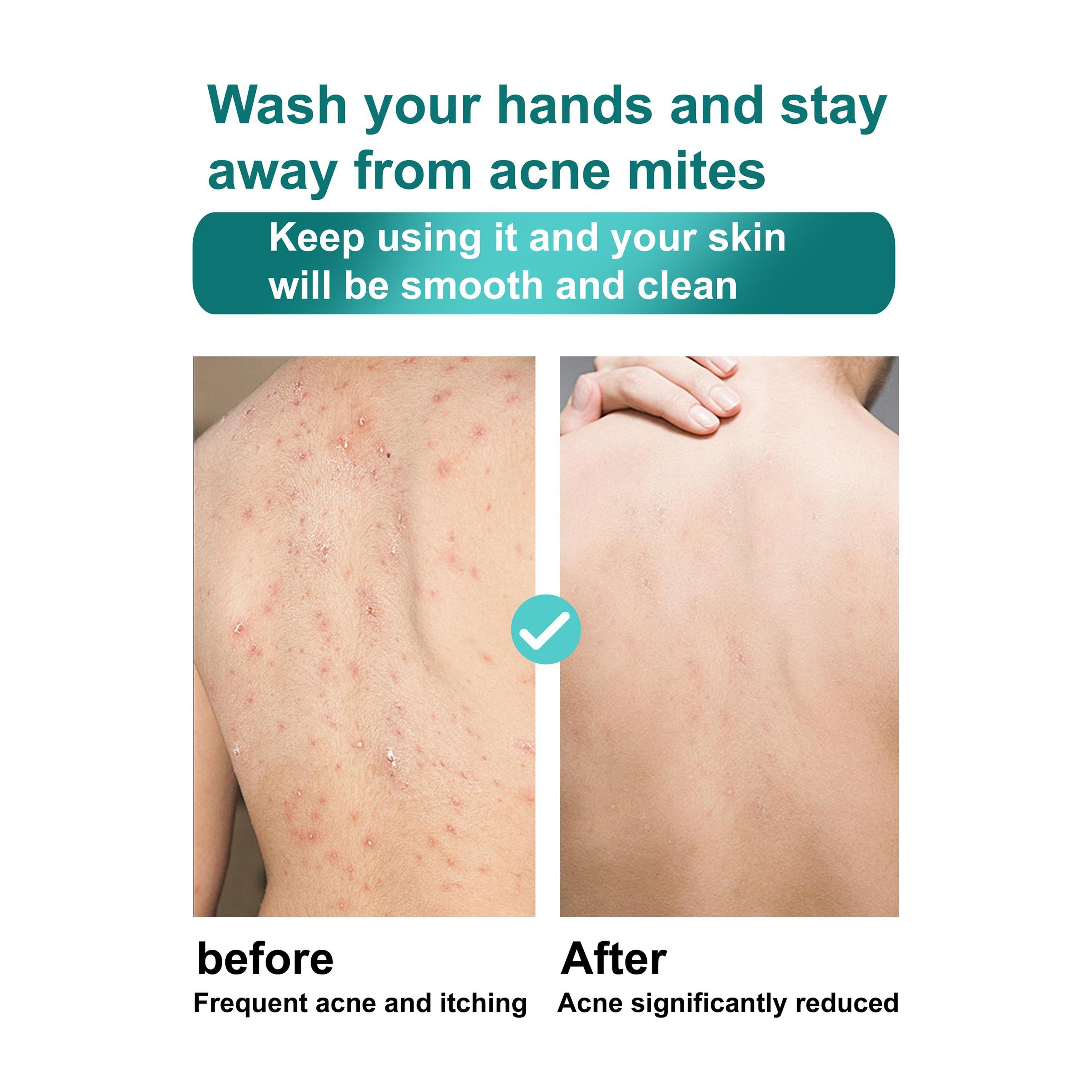 ROUSHUN Vitamin C Scrub Shower Gel Clean Skin Moisten Water Replenishing Long Lasting Fragrance Whitening Bubble Exfoliator