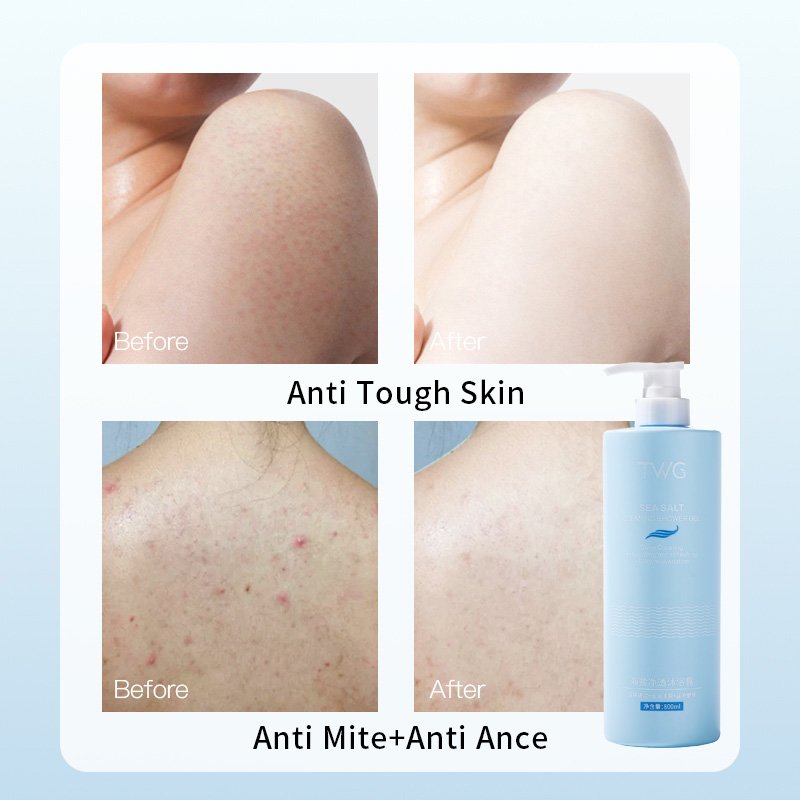 TWG Mite Removal Body Wash Anti Acne 800ml Large Family Use Size Body Cleanser Sea Salt Mineral Amino Acid Shower Gel