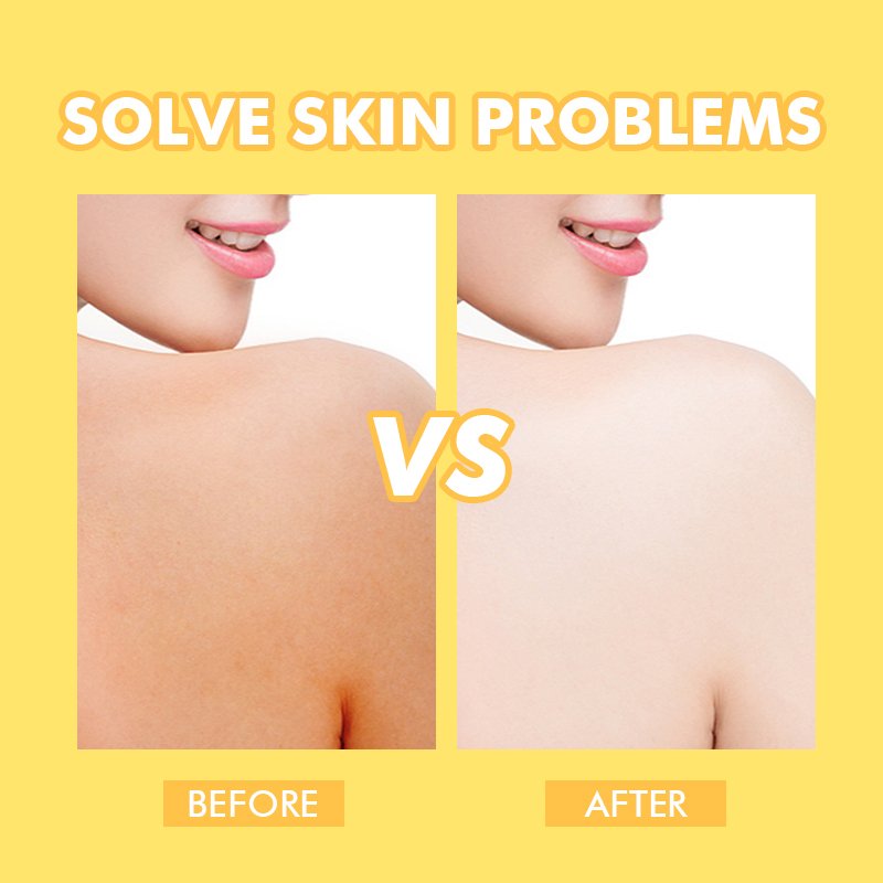 JMFREE Private Label Organic Natural Shower Gel Whitening Deeply Cleaning Kojic Acid Brightening Body Wash