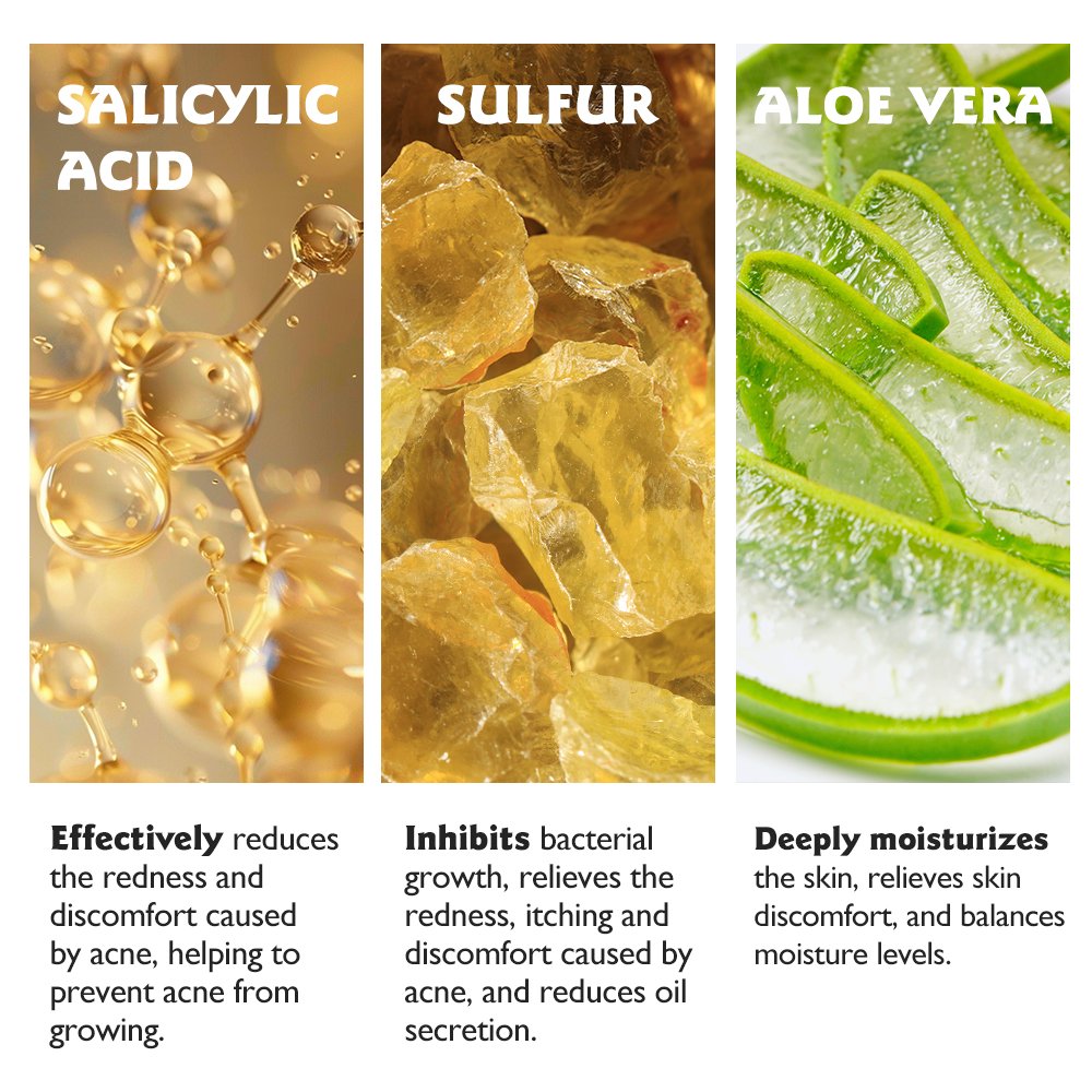 SKINEVER Refreshing Gel Body Wash Salicylic Acid Sulfur Infused Anti-Acne Anti-Mite Skin Care Adults Herbal Formula Liquid