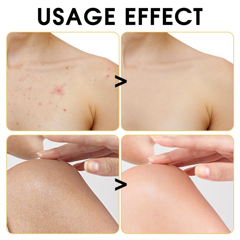 Korean Lightening Shower Gel Cruelty-free Repair & Moisturizing and Turmeric & Vitamin C Acne Treatment Body Wash