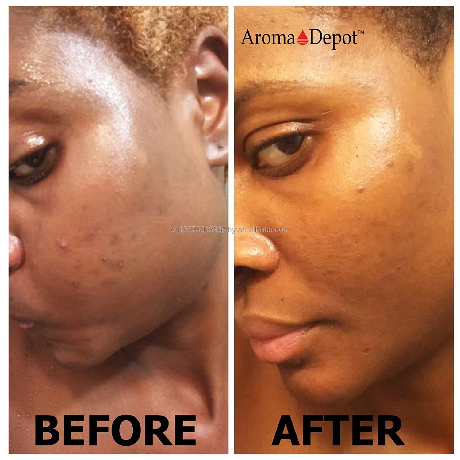 wholesale Natural Organic Ghana African Black Soap Whitening Raw African Black Soap For Acne