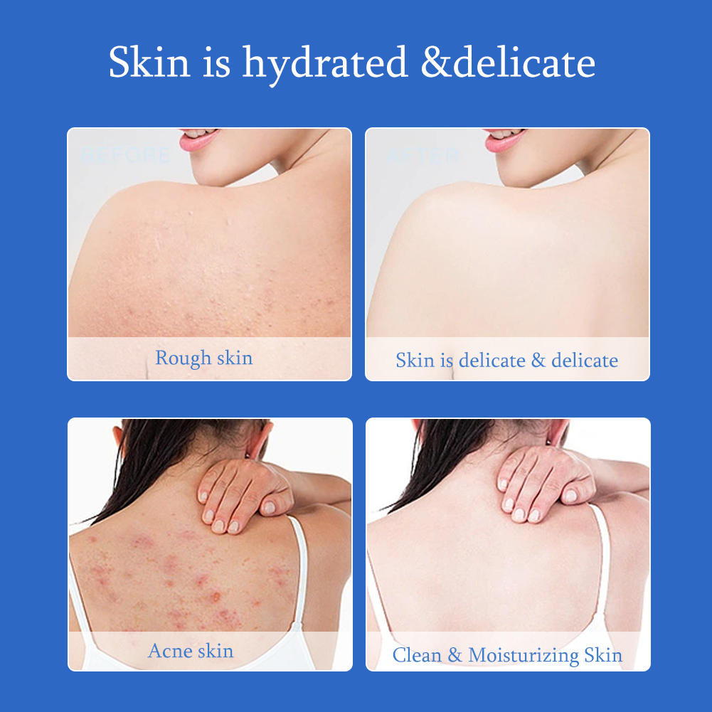 Remove Aged Cutin Nourishing Scalp Shower Gel Salicylic Acid Cleansing Refreshing Body Wash For Unisex Use