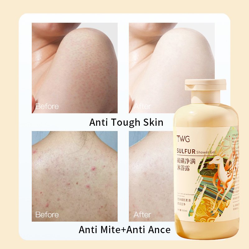 TWG Sulfur Body Cleansing Wholesale Dense Foam Deep Cleansing Anti Mite Oil Control Moisturizing Shower Gel