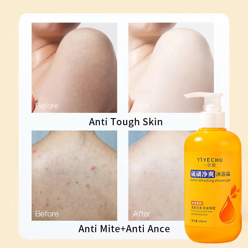 Yiyechu Showel Gel Factory Nourishing Body Wash Sulphur Anti Mite Refreshing Body Cleanser Deep-cleansing Anti Mite Shower Gel