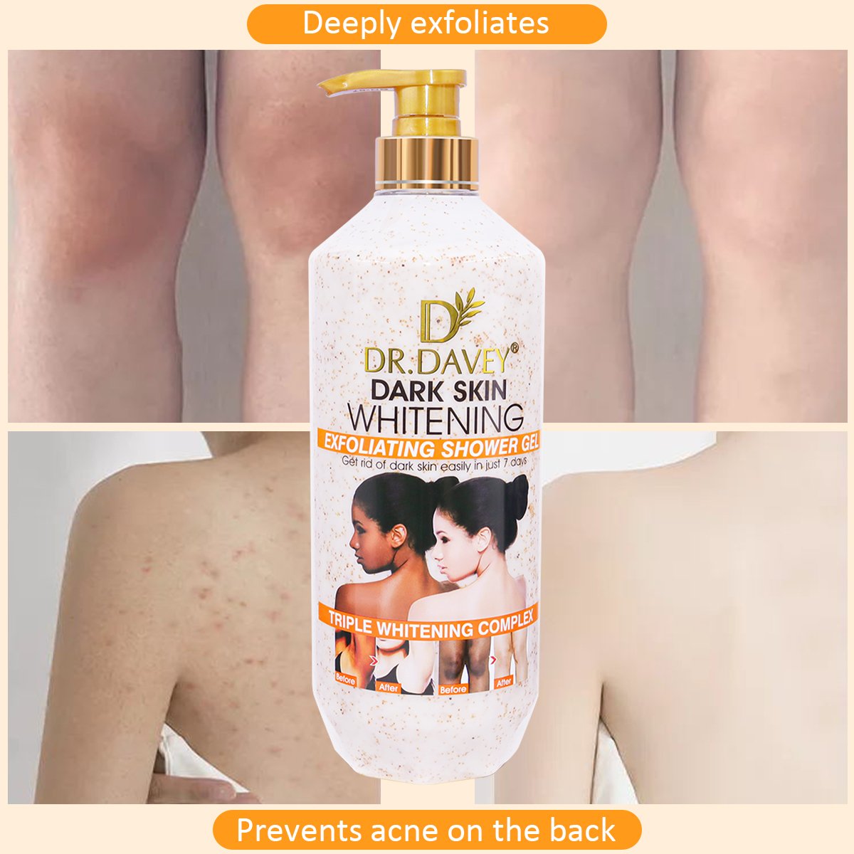 DR.DAVEY Scrub Body Wash Skin Lightening And Brightening Exfoliating Whitening Shower Gel