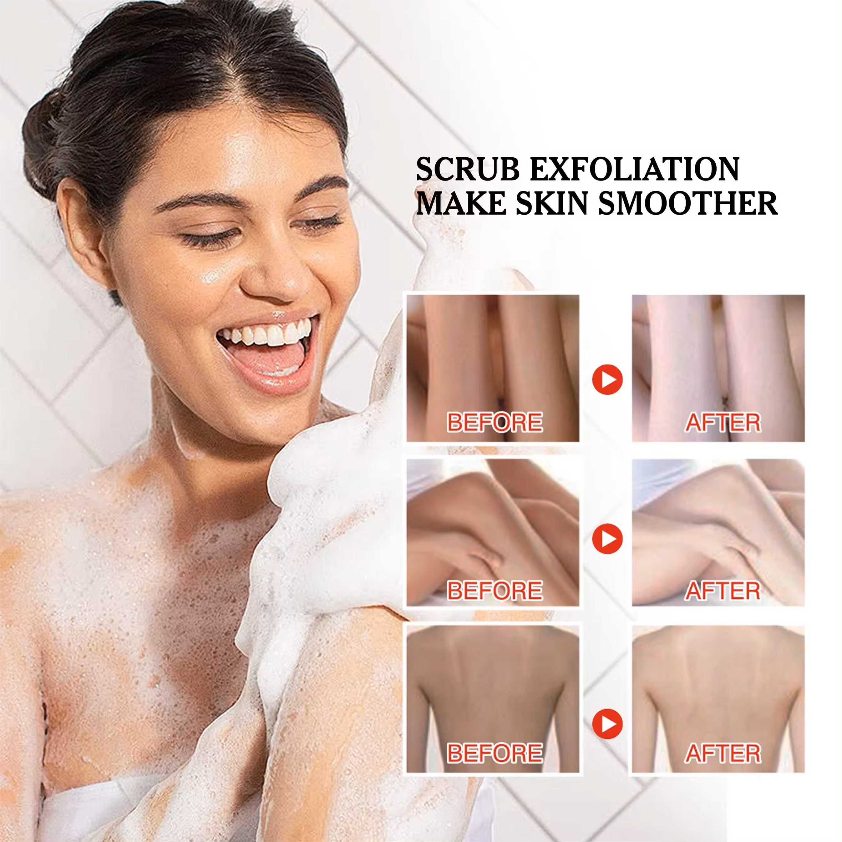 Half Cast Impove Back Acne Body Wash 10x Whitening Scrub Shower Gel