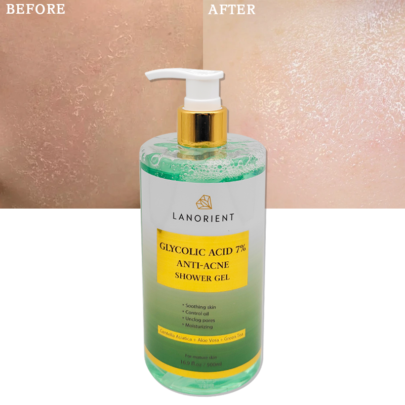 Factory Wholesale Vitamin E Glycolic Acid Remove Dark Spots Moisturizing Body Wash Exfoliating Shower Gel For Dark Skin