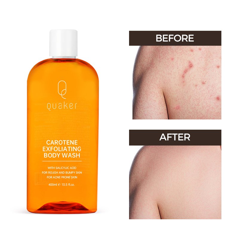 Qquaker Bathing Carotene Extract Skin Whitening Body Wash Liquid Soap Bath Shower Gel Carotone Bath Products