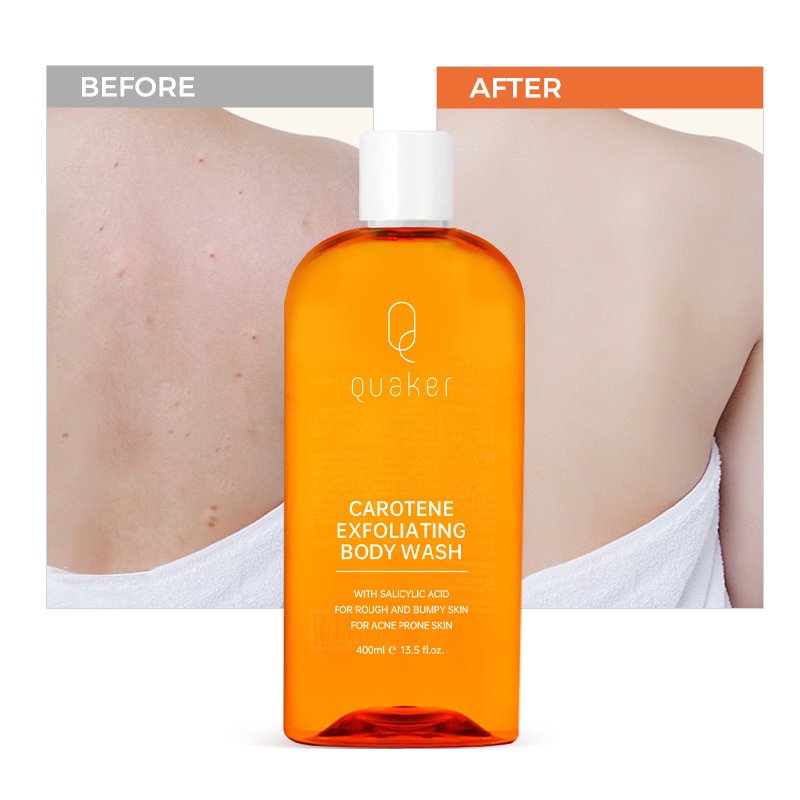 Qquaker Bathing Carotene Extract Skin Whitening Body Wash Liquid Soap Bath Shower Gel Carotone Bath Products