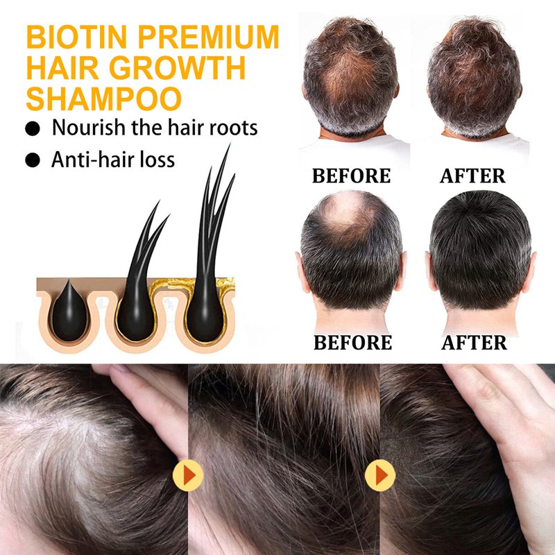 Private Label Red Onion Hair Growth Oil Cold Vegan Sulfate Free Shampoo and Conditioner Set Hair Fast Growth OEM