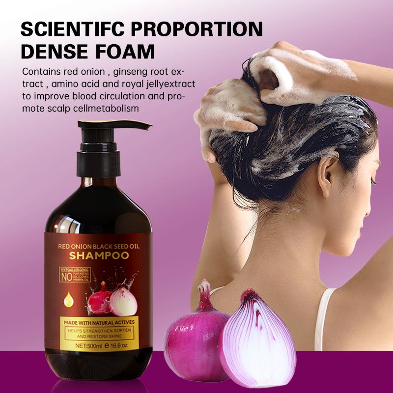 Private Label Red Onion Hair Growth Oil Cold Vegan Sulfate Free Shampoo and Conditioner Set Hair Fast Growth OEM