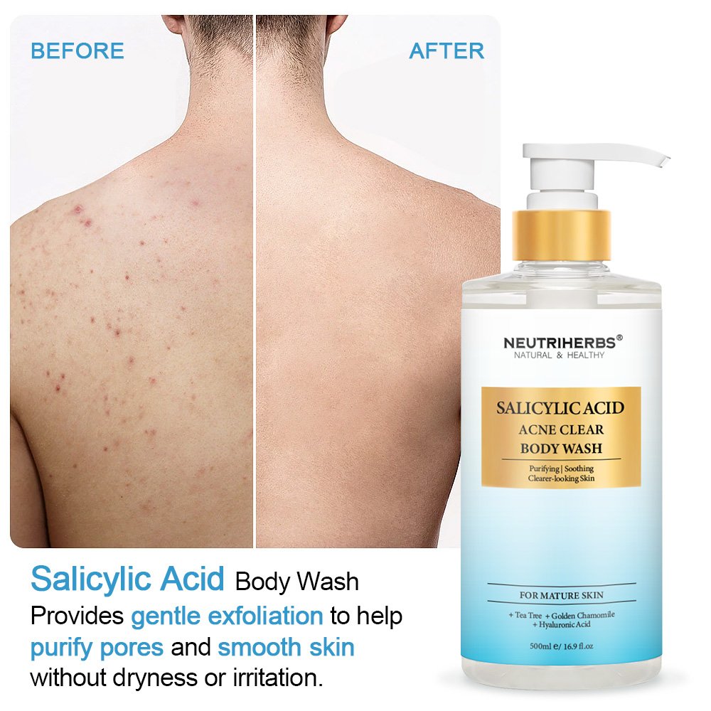 Natural Moisturizing Tea Tree Oil Salicylic Acid Private Label Anti Body Wash Exfoliating Shower Gel