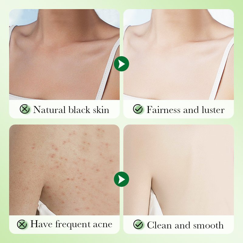 SADOER Private Label Honey Peach Vitamin C Fruit Skin Hydrating Body Wash Scrub Exfoliating Lightening Whitening Shower Gel