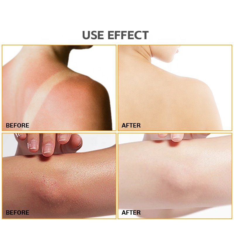 OEM Bath Acne White Lightening Liquid Body Wash Fragrance Shower Body Wash Private Label Shower Gel Whitening Shower G