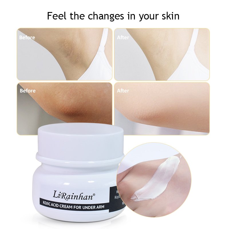whitening body cream strong bleaching KOJIC ACID CREAM FOR UNDER ARM body lotion for dry and sensitive lotion oemodm