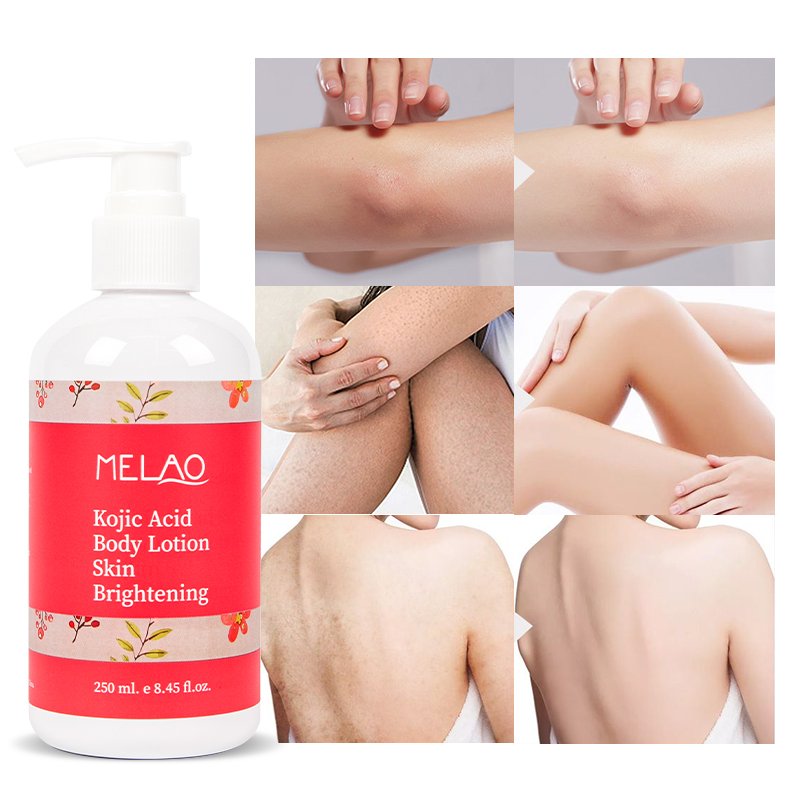OEM/ODM MELAO Private label premium vegan organic natural skin care whitening lightening nourishing kojic acid body lotion